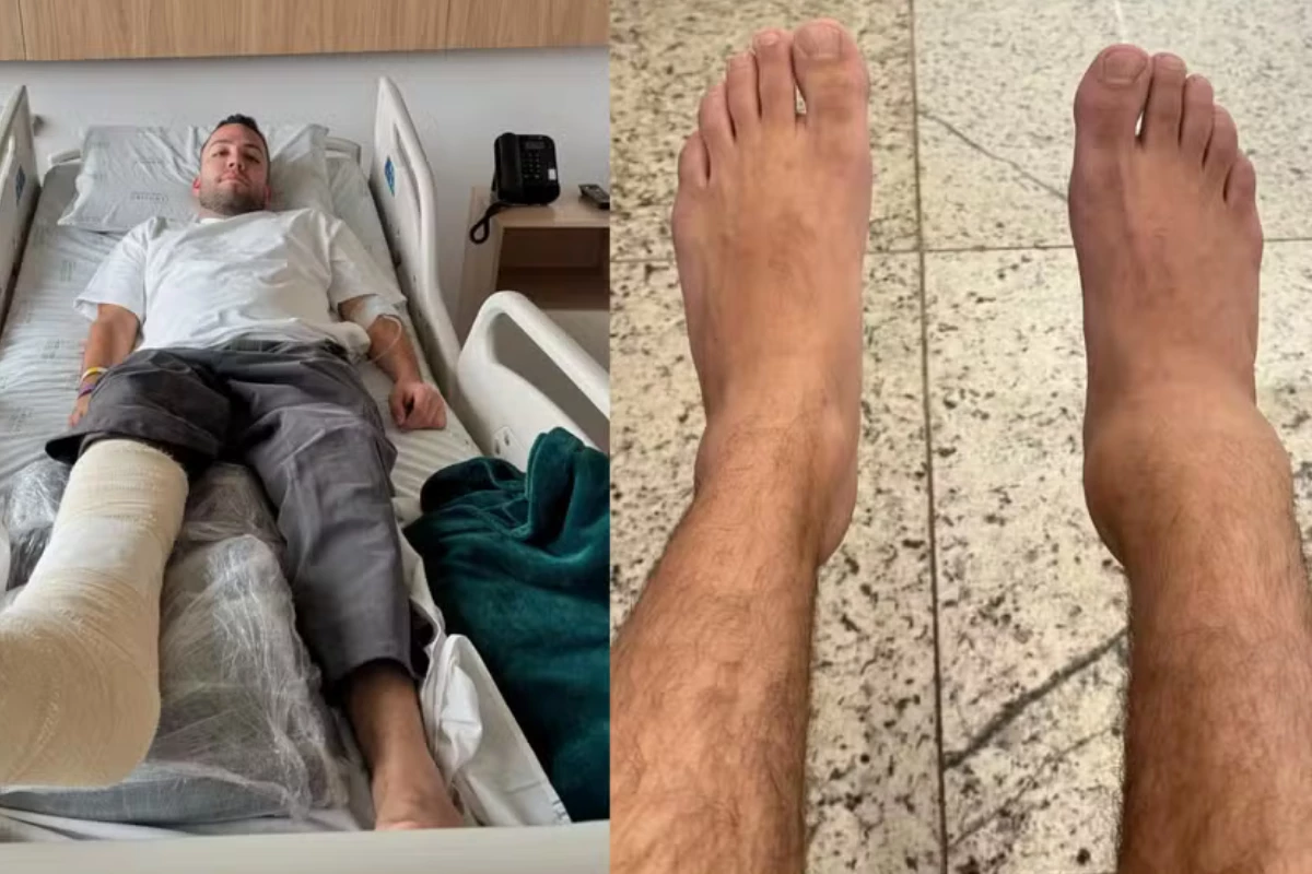 Ás vésperas do casamento, Lucas Rangel fratura a perna em acidente: ‘8 parafusos e uma placa!’ 31 As vesperas do casamento Lucas Rangel fratura a perna em