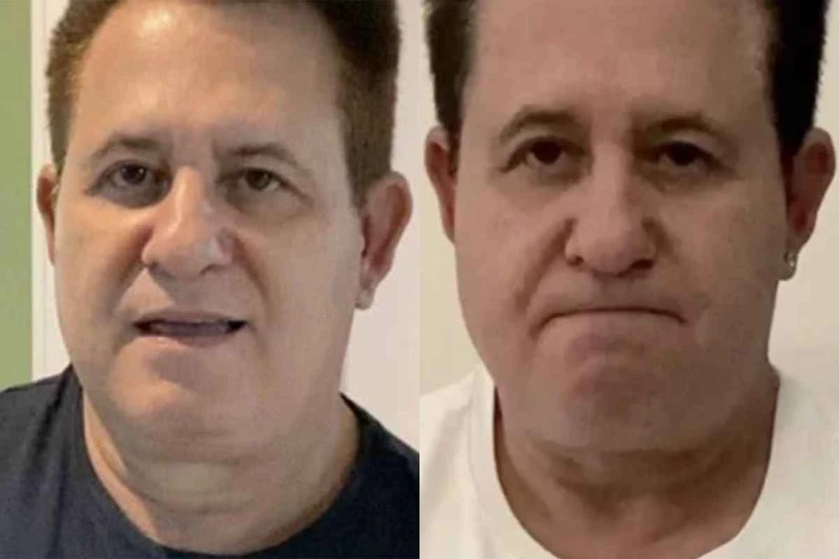 Cantor Marrone, da dupla com Bruno, faz forte desabafo por conta de cirurgias: ‘estava caído’ 31 Cantor Marrone da dupla com Bruno faz forte desabafo por