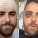 Chega ao fim a luta do cantor sertanejo Ze Neto