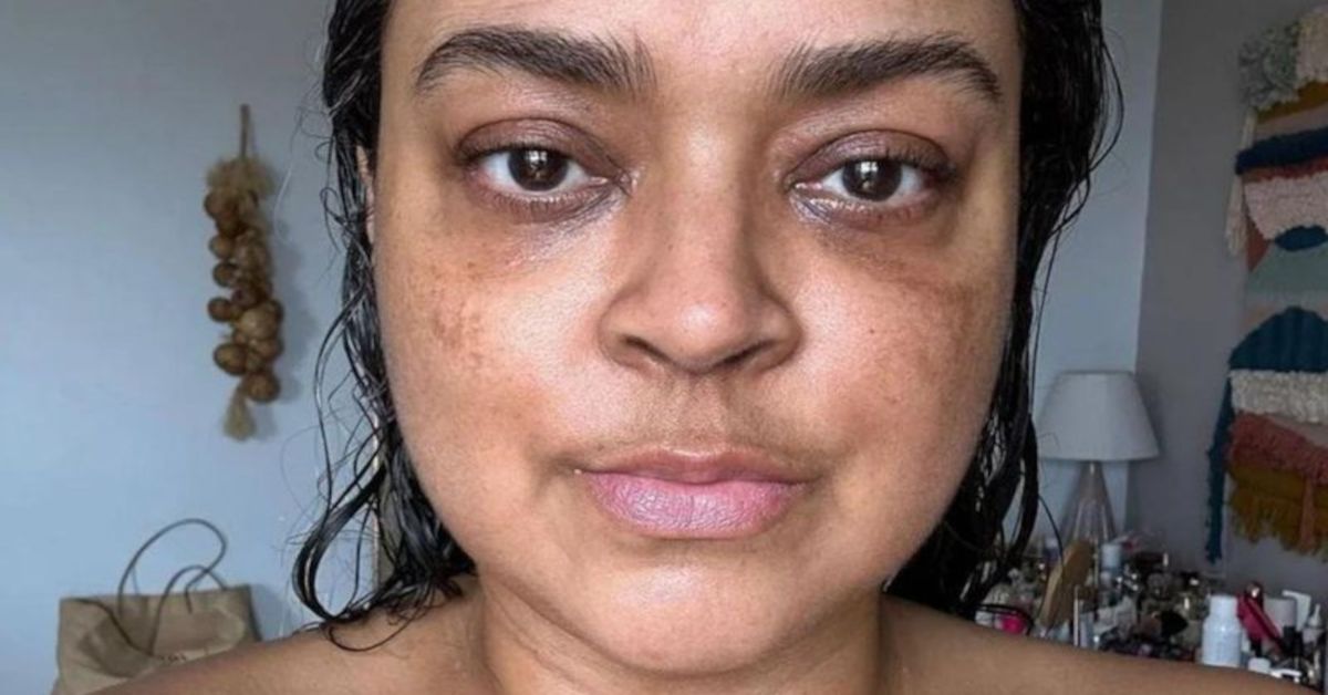 Chega triste notícia sobre Preta Gil que o Brasil não queria ouvir e médico se pronuncia 31 Chega triste noticia sobre Preta Gil que o Brasil nao