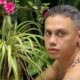 Especialista explica diagnostico e cuidados da doenca de Silvero Pereira