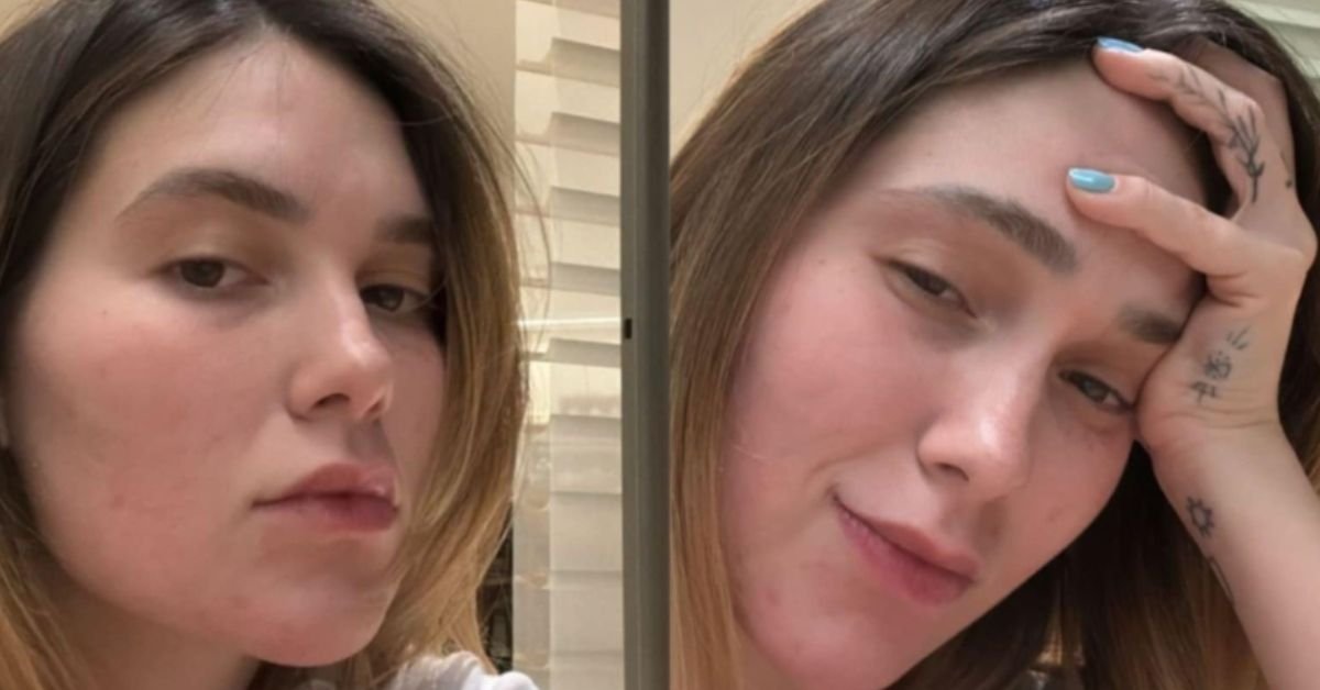 Fotos Apos mudanca de visual Virginia exibe falhas no cabelo