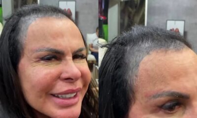 Gretchen conta como ‘perdeu todo o cabelo cantora abre o