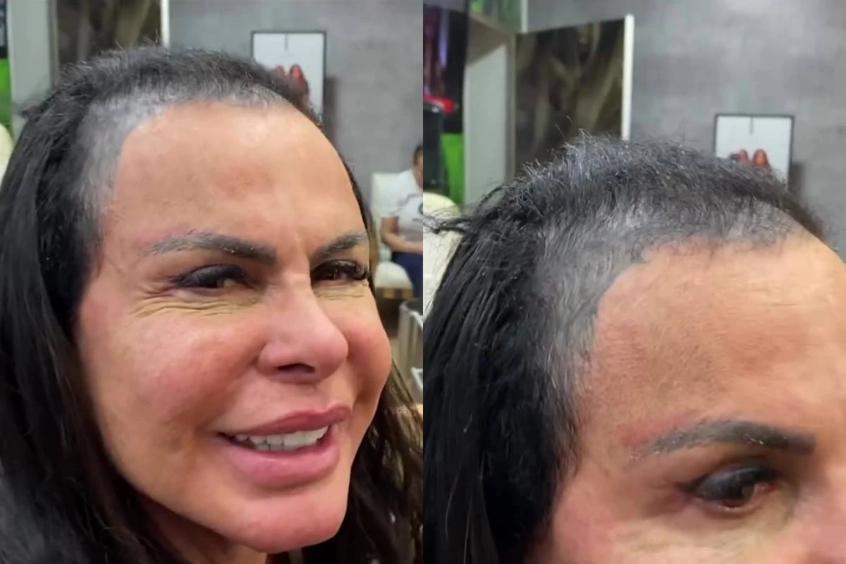 Gretchen conta como ‘perdeu todo o cabelo’; cantora abre o jogo e mostra como é a cabeça sem a prótese capilar 31 Gretchen conta como ‘perdeu todo o cabelo cantora abre o