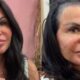 Gretchen e detonada apos exibir parte do couro cabelo careca