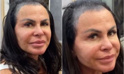 Gretchen mostra cabelo sem protese capilar e chama a atencao