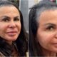 Gretchen mostra cabelo sem protese capilar e chama a atencao