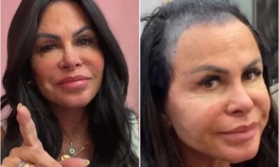 Gretchen recebe criticas apos mostrar perda de cabelo mas nao
