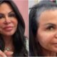 Gretchen recebe criticas apos mostrar perda de cabelo mas nao