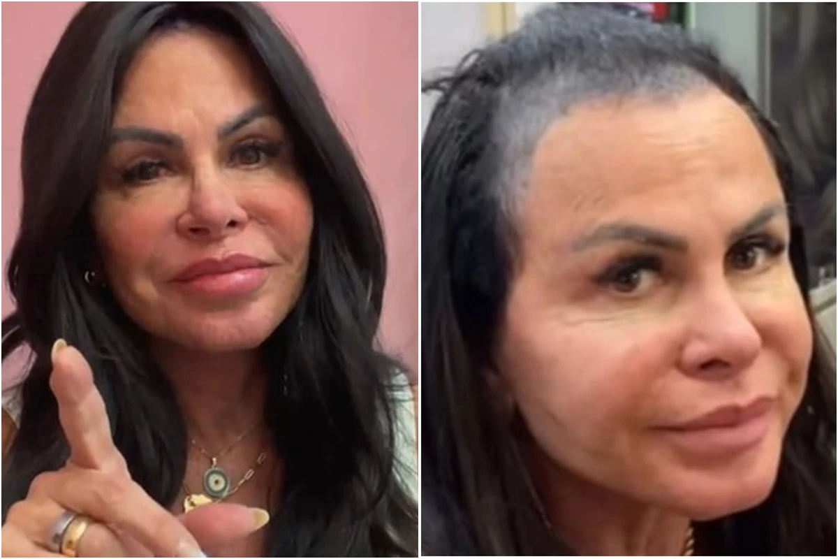 Gretchen recebe críticas após mostrar perda de cabelo, mas não se cala e responde na lata 31 Gretchen recebe criticas apos mostrar perda de cabelo mas nao