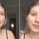 Isabel Veloso explica aparencia saudavel e como e o tratamento