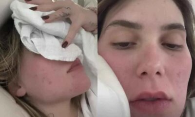 Luta de Virginia Fonseca contra vicio e exposta em forte