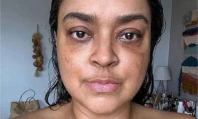 Lutando contra o cancer Preta Gil abre o coracao sobre.webp