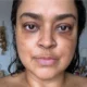 Lutando contra o cancer Preta Gil abre o coracao sobre.webp
