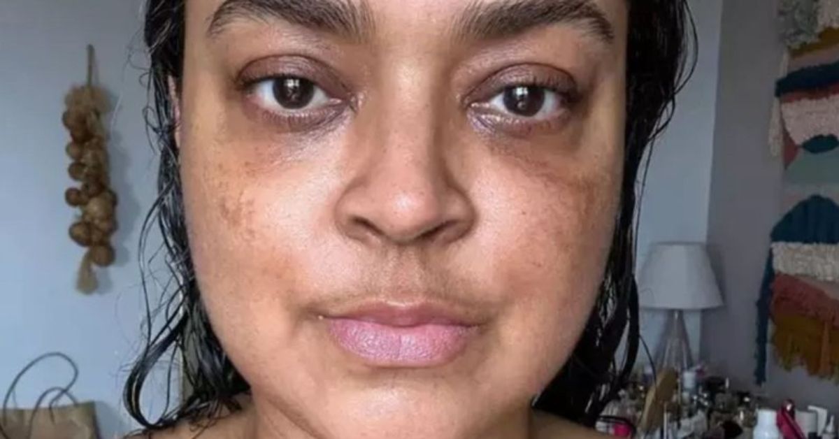 Preta Gil faz desabafa comovente sobre a exaustiva batalha contra o câncer: ‘Muito cansada’ 31 Preta Gil faz desabafa comovente sobre a exaustiva batalha contra