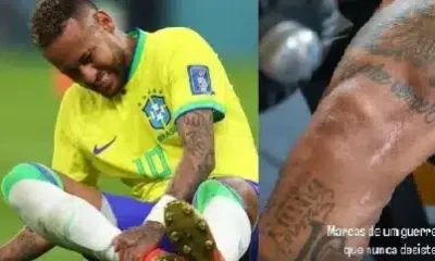 Proximo do retorno Neymar mostra cicatrizes das cirurgias.webp