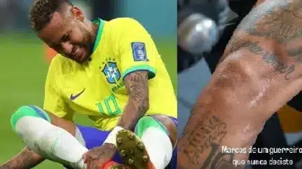 Próximo do retorno, Neymar mostra cicatrizes das cirurgias 31 Proximo do retorno Neymar mostra cicatrizes das cirurgias.webp