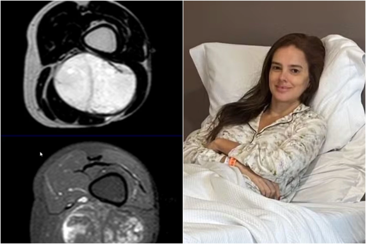 Vera Viel se manifesta antes de cirurgia para retirada de câncer maligno raro: ‘de onde me vira o socorro?’ 35 Vera Viel se manifesta antes de cirurgia para retirada de
