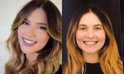 Virginia exibe novo sorriso após trocar lentes de contato dos dentes