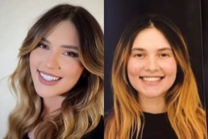 Virginia exibe novo sorriso após trocar lentes de contato dos dentes 31 Virginia exibe novo sorriso após trocar lentes de contato dos dentes