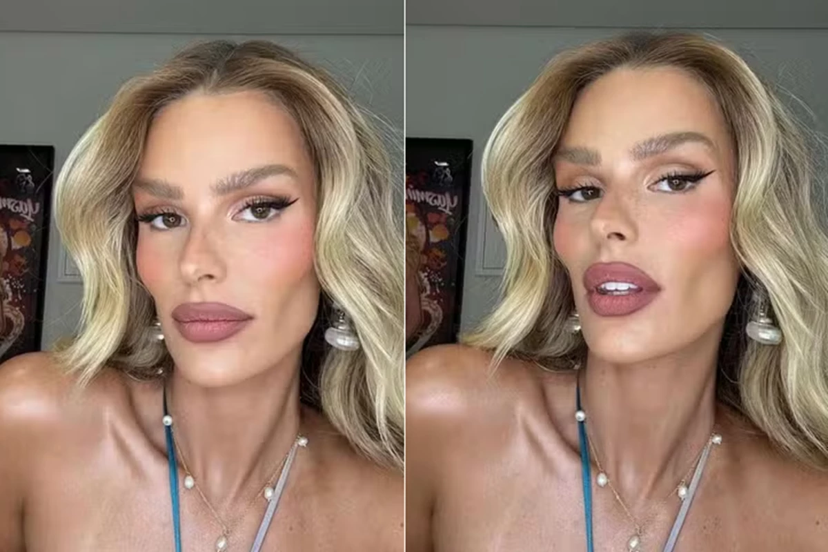 Yasmin Brunet aparece completamente diferente e o motivo é revelado: ‘O que aconteceu com seu rosto?’ 31 Yasmin Brunet aparece completamente diferente e o motivo e revelado