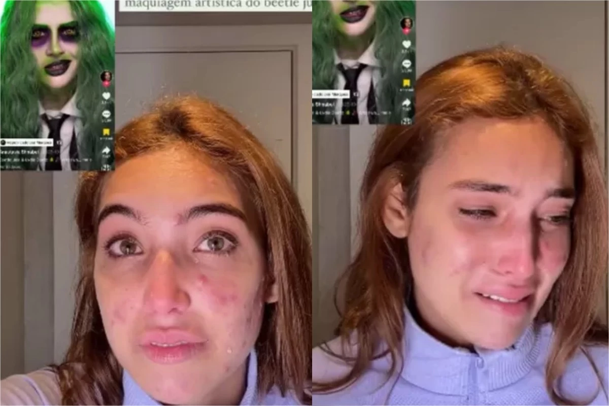 ‘Me senti um monstro’: vídeo mostra influenciadora aos prantos, enquanto fala de sua aparência 31 ‘Me senti um monstro video mostra influenciadora aos prantos enquanto