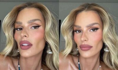 Apos exibir mudanca de visual Yasmin Brunet promete processar medicos