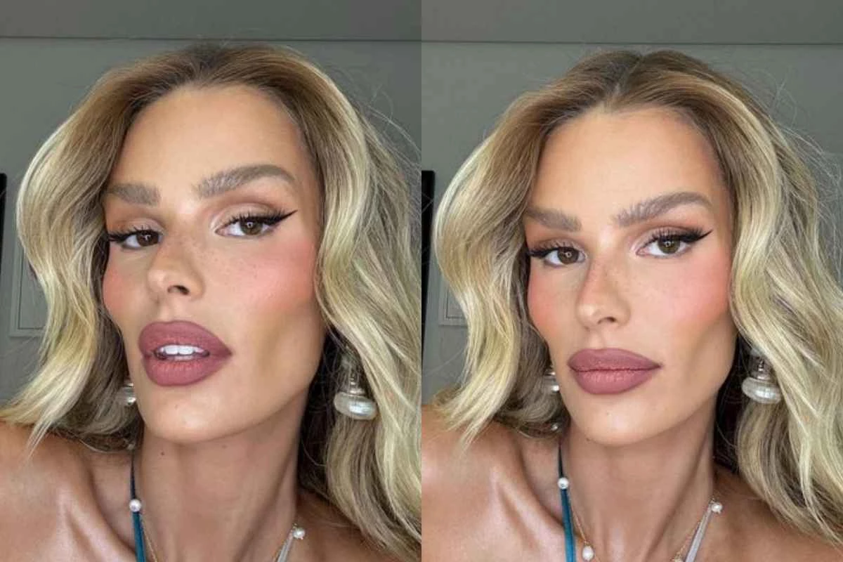 Após exibir mudança de visual, Yasmin Brunet promete processar médicos: ‘Cansei, agora vai ser na Justiça’ 33 Apos exibir mudanca de visual Yasmin Brunet promete processar medicos