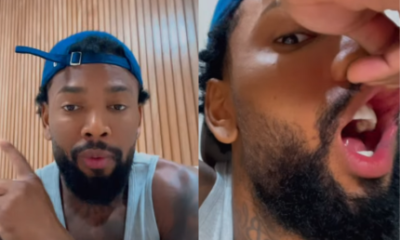 Atingido por trás e pontos na boca: Nego do Borel detalha briga no RJ