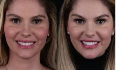 Bárbara Evans mexe no rosto após remover excesso de gordura do corpo. Veja o resultado!