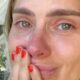Carolina Dieckmann sofre acidente enquanto gravava cena de filme e