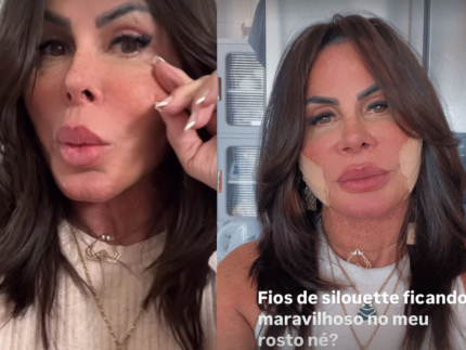 Gretchen aparece sem curativos e rebate haters que a chamaram de “fofão” 31 Gretchen aparece sem curativos e rebate haters que a chamaram de “fofão”
