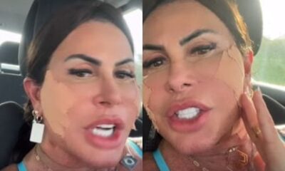 Gretchen atualiza sobre nova cirurgia plástica e rebate haters: “Bem amada”