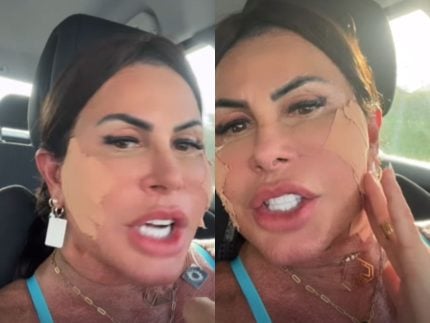 Gretchen atualiza sobre nova cirurgia plástica e rebate haters: “Bem amada” 31 Gretchen atualiza sobre nova cirurgia plástica e rebate haters: “Bem amada”