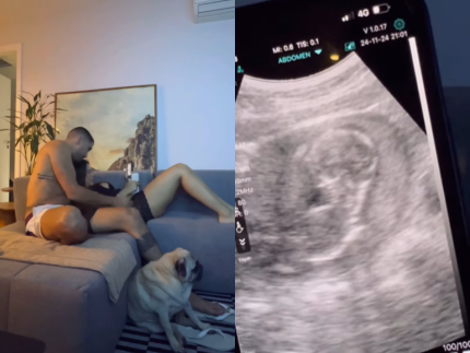 Lexa compra ultrassom portátil para ver a filha e explica: “Não faz mal” 31 Lexa compra ultrassom portátil para ver a filha e explica: “Não faz mal”