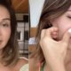 Maira Cardi revela complicacoes de procedimento estetico e cita Andressa