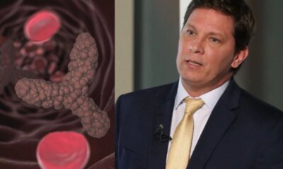 Medica explica condicao de saude de Mario Frias e alerta