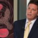 Medica explica condicao de saude de Mario Frias e alerta