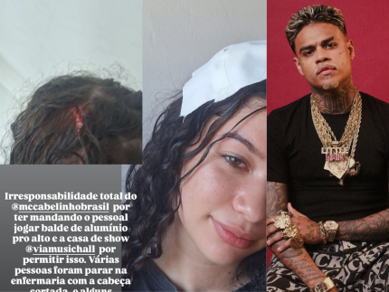 Mulher leva 3 pontos na cabeça após ser atingida por balde em show de MC Cabelinho 31 Mulher leva 3 pontos na cabeça após ser atingida por balde em show de MC Cabelinho