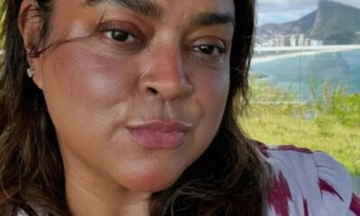 Preta Gil descobre nova doenca e faz cirurgia de emergencia