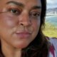 Preta Gil descobre nova doenca e faz cirurgia de emergencia