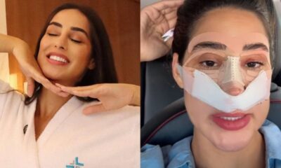 Quanto custa uma rinoplastia Ex BBB Deniziane revela ter investido uma