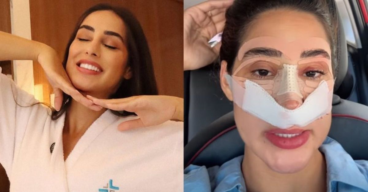 Quanto custa uma rinoplastia Ex BBB Deniziane revela ter investido uma