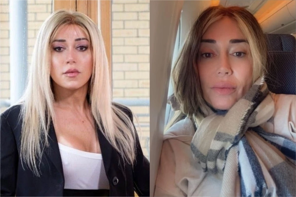 ‘Me deu gases’: Mulher Abacaxi passa vergonha em voo após comer 20 ovos; ela copiou a dieta da Virginia 31 ‘Me deu gases Mulher Abacaxi passa vergonha em voo apos