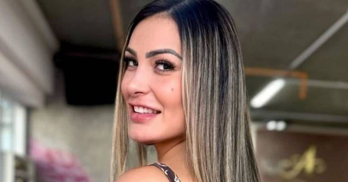 Andressa Urach surpreende com novo procedimento estetico e exibe resultado