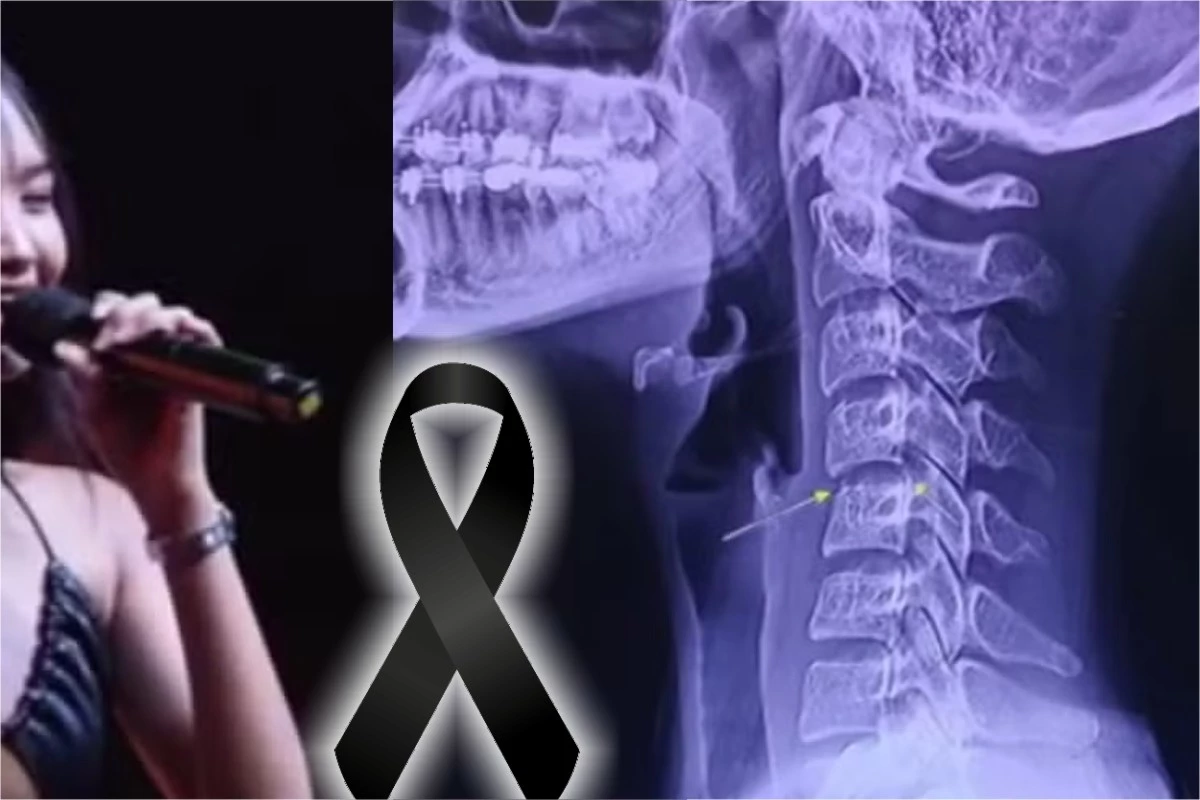 Cantora de 20 anos faz sessão de massagem e falece após ter vértebra deslocada 35 Cantora de 20 anos faz sessao de massagem e falece