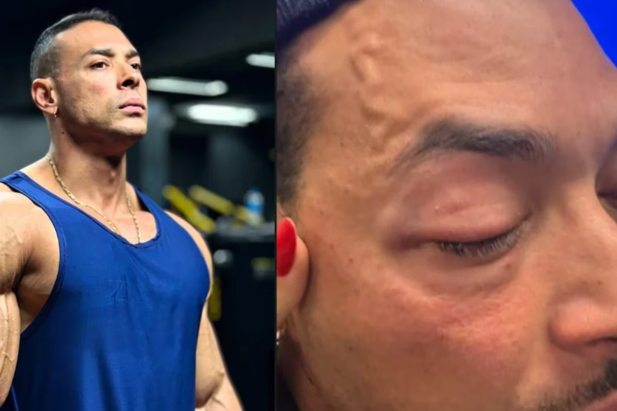 Chorando, Felipe Franco, deputado e influenciador fitness, surge acusando PM de agressão 31 Chorando Felipe Franco deputado e influenciador fitness surge acusando PM