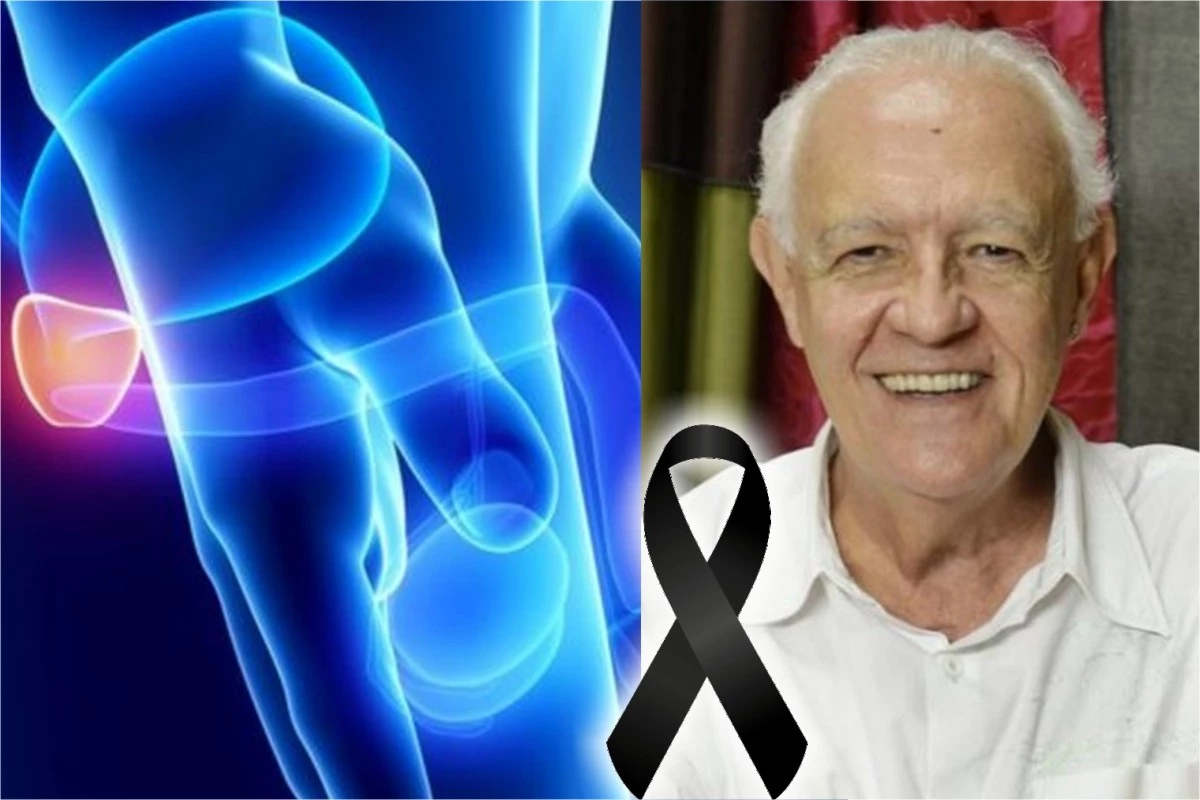 Doença que matou o ator Ney Latorraca é muito comum entre os homens 31 Doenca que matou o ator Ney Latorraca e muito comum