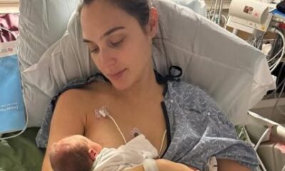 Gal Gadot revela coagulo no cerebro e parto de emergencia