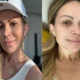 Medica entrega detalhe de tratamento para vicio de Solange